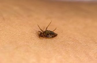 What Can I Put on My Body to Prevent Bed Bug Bites List of Effective Remedies