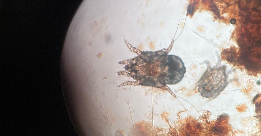 mite under the microscope