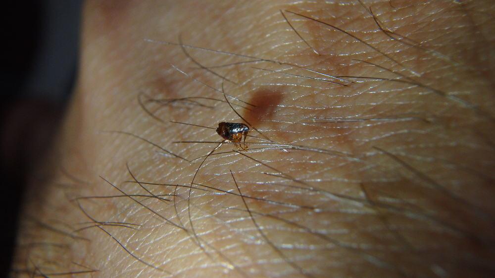 flea on a human body