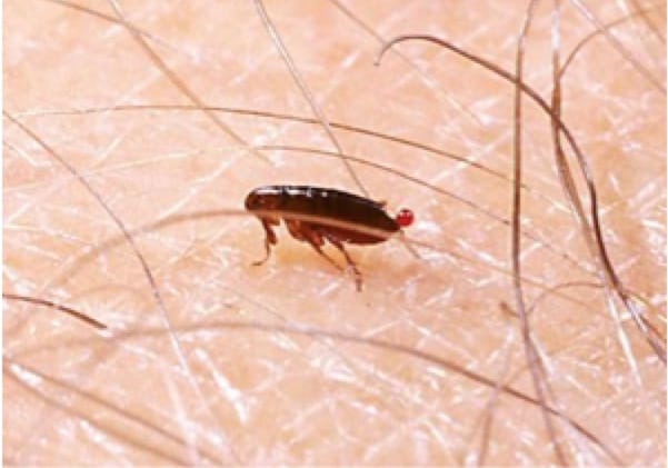 flea on human skin