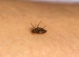 What Can I Put on My Body to Prevent Bed Bug Bites: List of Effective Remedies